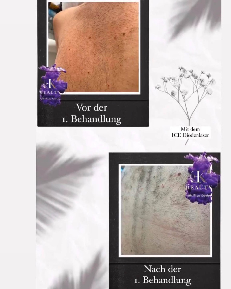 Hautbild vorher/nachher